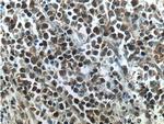 SMNDC1 Antibody in Immunohistochemistry (Paraffin) (IHC (P))