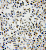 SMNDC1 Antibody in Immunohistochemistry (Paraffin) (IHC (P))