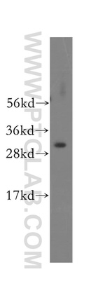 SMNDC1 Antibody in Western Blot (WB)