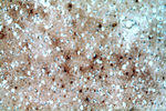 MT3 Antibody in Immunohistochemistry (Paraffin) (IHC (P))