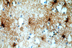 MT3 Antibody in Immunohistochemistry (Paraffin) (IHC (P))