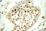 MT3 Antibody in Immunohistochemistry (Paraffin) (IHC (P))