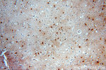 MT3 Antibody in Immunohistochemistry (Paraffin) (IHC (P))