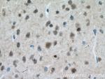 MT3 Antibody in Immunohistochemistry (Paraffin) (IHC (P))