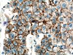 p120 Catenin Antibody in Immunohistochemistry (Paraffin) (IHC (P))