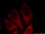 p120 Catenin Antibody in Immunocytochemistry (ICC/IF)