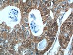 p120 Catenin Antibody in Immunohistochemistry (Paraffin) (IHC (P))