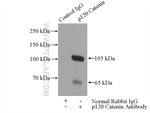 p120 Catenin Antibody in Immunoprecipitation (IP)