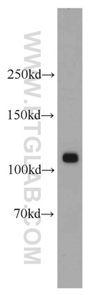 p120 Catenin Antibody in Western Blot (WB)