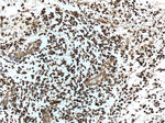 NDRG4 Antibody in Immunohistochemistry (Paraffin) (IHC (P))