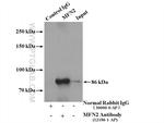 MFN2 Antibody in Immunoprecipitation (IP)