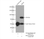 MFN2 Antibody in Immunoprecipitation (IP)