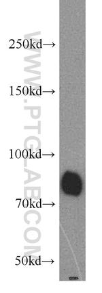 MFN2 Antibody in Western Blot (WB)