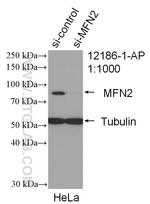 MFN2 Antibody in Western Blot (WB)