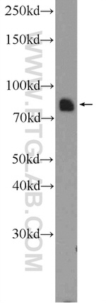 MFN2 Antibody in Western Blot (WB)