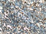 alpha 1 Antichymotrypsin Antibody in Immunohistochemistry (Paraffin) (IHC (P))