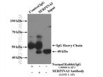 alpha 1 Antichymotrypsin Antibody in Immunoprecipitation (IP)