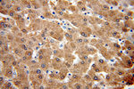 alpha 1 Antichymotrypsin Antibody in Immunohistochemistry (Paraffin) (IHC (P))