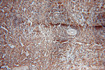 alpha 1 Antichymotrypsin Antibody in Immunohistochemistry (Paraffin) (IHC (P))