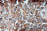 alpha 1 Antichymotrypsin Antibody in Immunohistochemistry (Paraffin) (IHC (P))