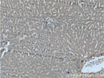 alpha 1 Antichymotrypsin Antibody in Immunohistochemistry (Paraffin) (IHC (P))