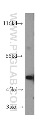 alpha 1 Antichymotrypsin Antibody in Western Blot (WB)