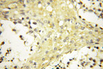 VPS33B Antibody in Immunohistochemistry (Paraffin) (IHC (P))