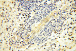 VPS33B Antibody in Immunohistochemistry (Paraffin) (IHC (P))