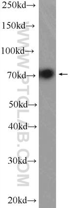 VPS33B Antibody in Western Blot (WB)