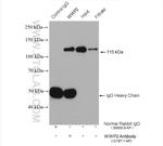 WWP2 Antibody in Immunoprecipitation (IP)