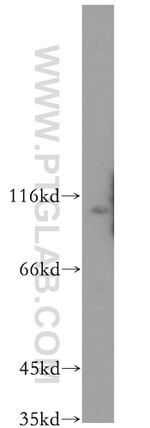 WWP2 Antibody in Western Blot (WB)