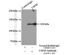 USP25 Antibody in Immunoprecipitation (IP)