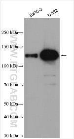 USP25 Antibody in Western Blot (WB)