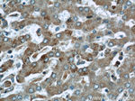 ABHD5 Antibody in Immunohistochemistry (Paraffin) (IHC (P))