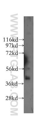 ABHD5 Antibody in Western Blot (WB)