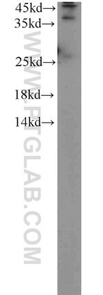 ABHD5 Antibody in Western Blot (WB)