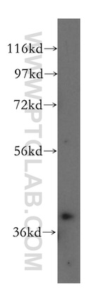 ABHD5 Antibody in Western Blot (WB)