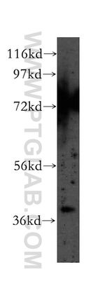 ABHD5 Antibody in Western Blot (WB)