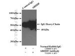 ABHD5 Antibody in Immunoprecipitation (IP)