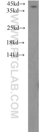 ABHD5 Antibody in Western Blot (WB)