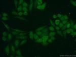 TRIM27 Antibody in Immunocytochemistry (ICC/IF)