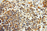 TRIM27 Antibody in Immunohistochemistry (Paraffin) (IHC (P))