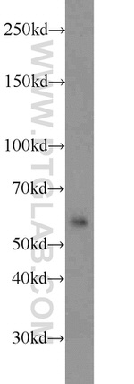 TRIM27 Antibody in Western Blot (WB)