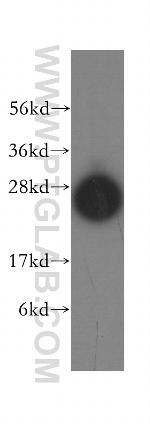 Syntaxin 8 Antibody in Western Blot (WB)