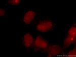 CREB1 Antibody in Immunocytochemistry (ICC/IF)