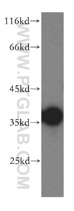 CPOX Antibody in Western Blot (WB)