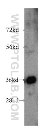 CPOX Antibody in Western Blot (WB)