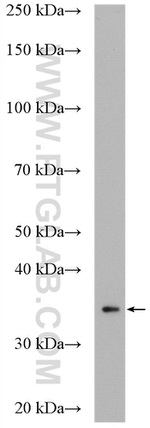 CPOX Antibody in Western Blot (WB)