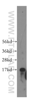 SSBP1 Antibody in Western Blot (WB)