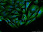 Cathepsin B Antibody in Immunocytochemistry (ICC/IF)